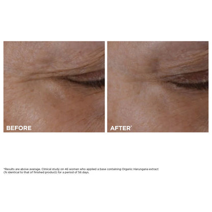 Total Eye Lift Refillable Eye Cream for Firming